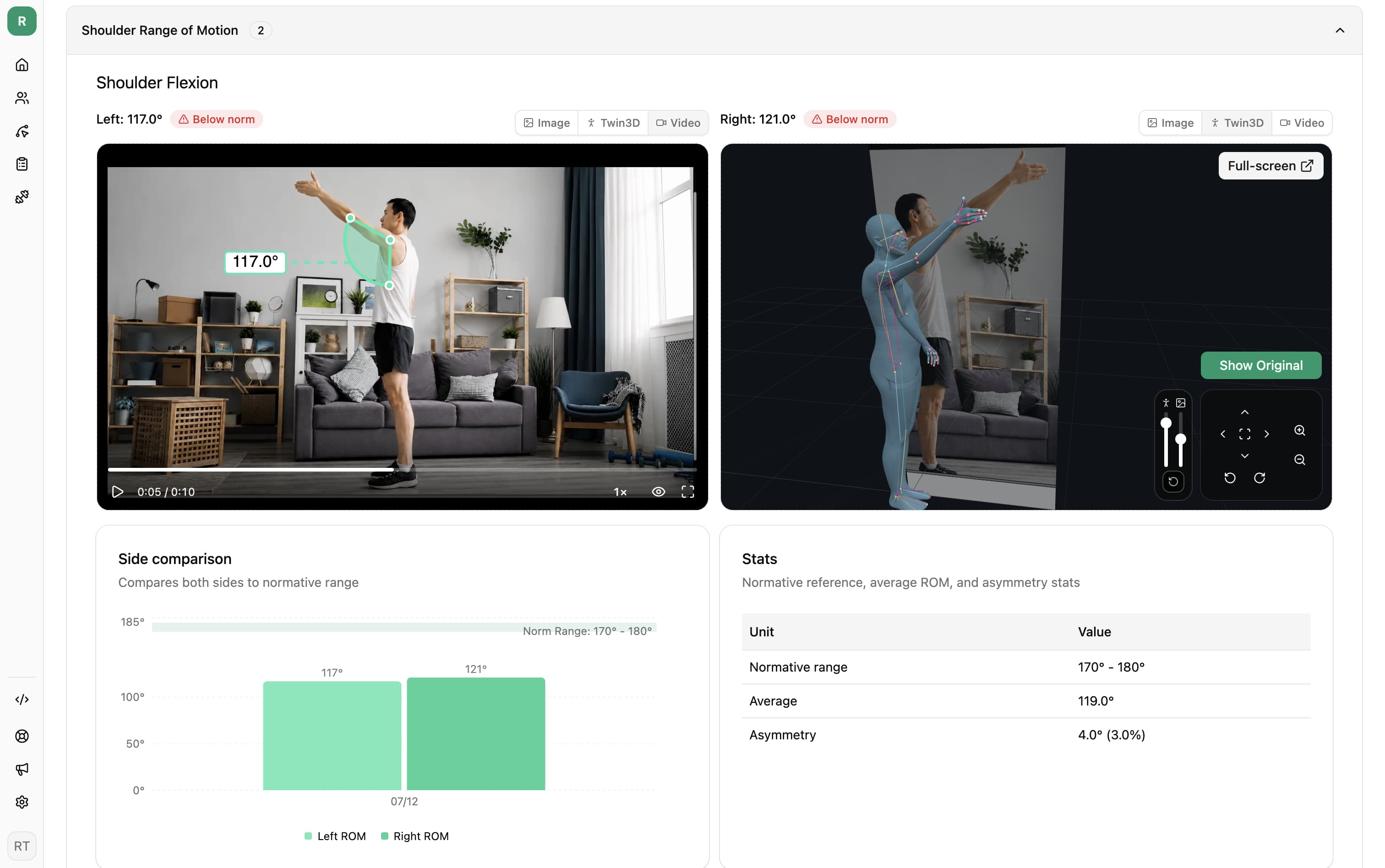 Revenite shoulder flexion results with video, 3D analysis, and range of motion comparison